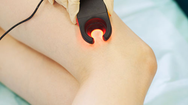 ULTRASOUND GUIDED SCLEROTHERAPY