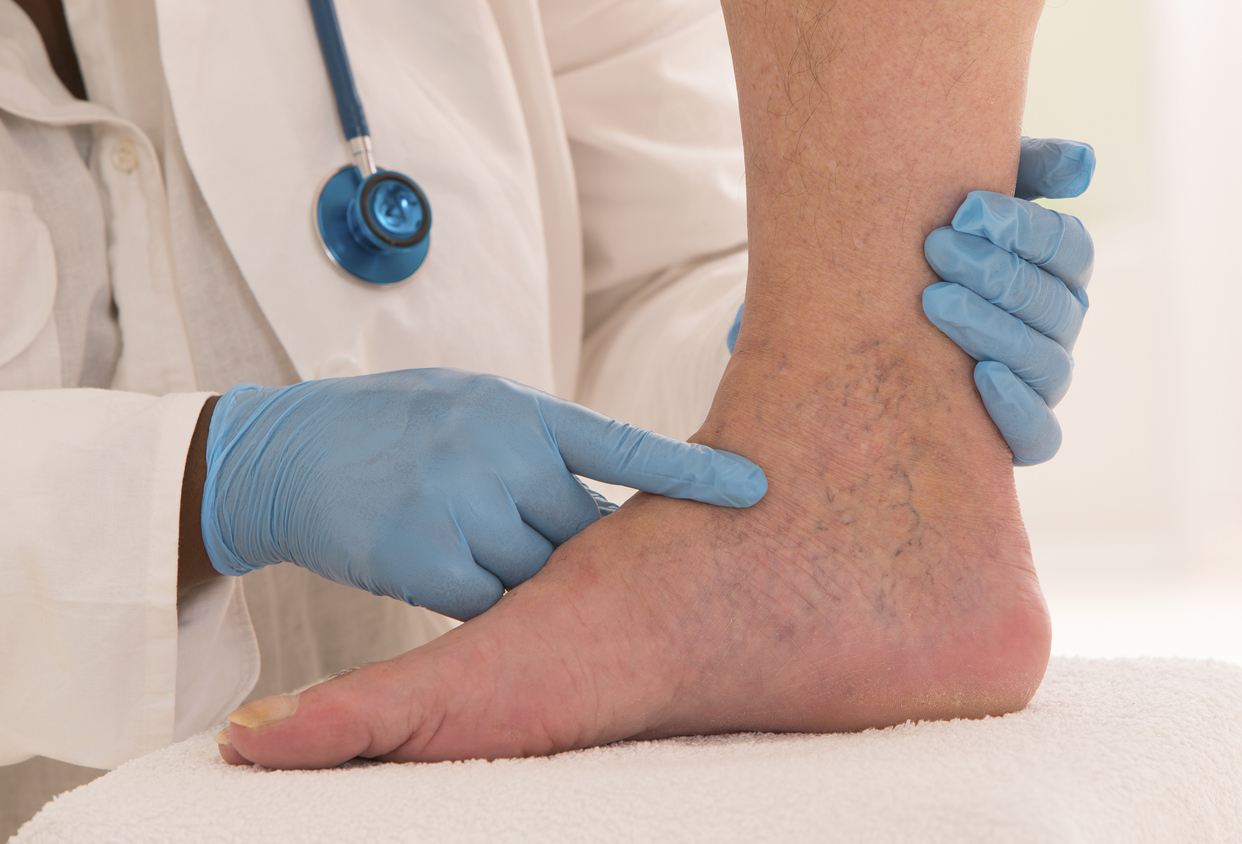 doctor performing lower limb vascular examination on patient's ankle