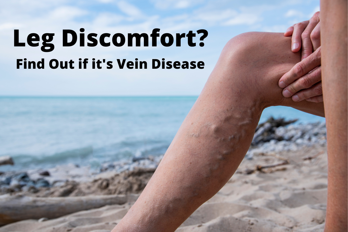 Signs of Vein Disease