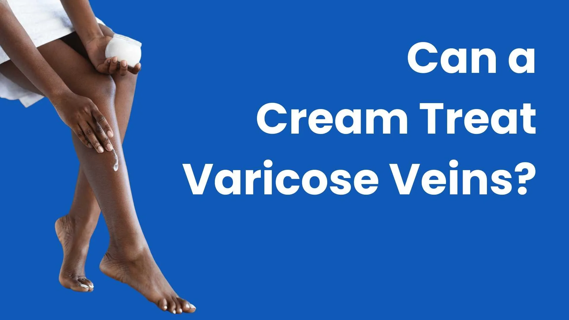 Can a cream treat varicose veins