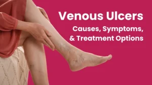 Venous ulcers