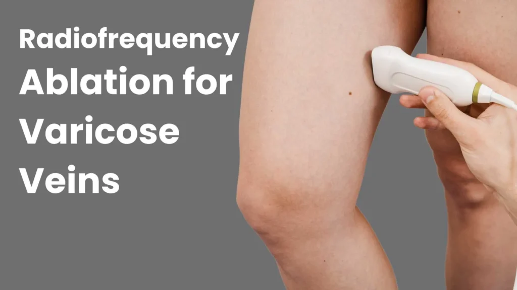 Radiofrequency ablation