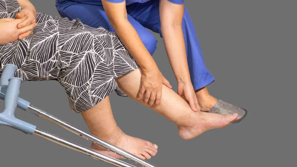 lymphedema treatment