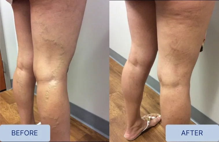 Before vs after treatment