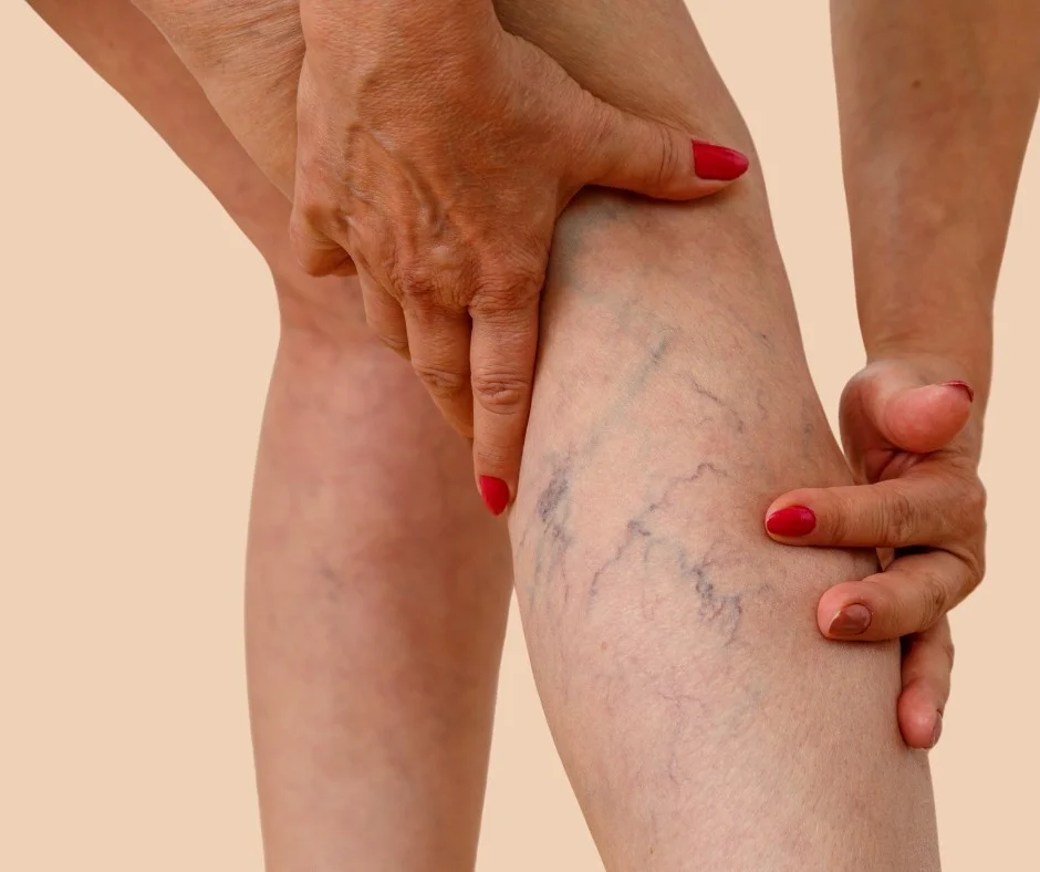 restless leg syndrome